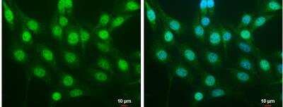 NIH/3T3 cells were fixed in 4% paraformaldehyde at RT for 15 min. Green: NRF2 protein stained by NRF2 antibody [N2C2], Internal diluted at 1:500. Blue: Hoechst 33342 staining. Scale bar = 10 um.