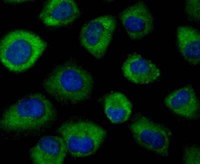 Immunocytochemistry/Immunofluorescence: Nrf2 Antibody [NBP3-09069] - ICC staining of Nrf2 in Huvec cells (green). Formalin fixed cells were permeabilized with 0.1% Triton X-100 in TBS for 10 minutes at room temperature and blocked with 1% Blocker BSA for 15 minutes at room temperature. Cells were probed with the primary antibody (ER1706-41, 1/500) for 1 hour at room temperature, washed with PBS. Alexa Fluor (TM) 488 Goat anti-Rabbit IgG was used as the secondary antibody at 1/100 dilution. The nuclear counter stain is DAPI (blue).