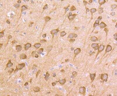 Immunohistochemistry-Paraffin: Nrf2 Antibody [NBP3-09069] - Immunohistochemical analysis of paraffin-embedded rat brain tissue using anti-Nrf2 antibody. The section was pre-treated using heat mediated antigen retrieval with Tris-EDTA buffer (pH 8.0-8.4) for 20 minutes.The tissues were blocked in 5% BSA for 30 minutes at room temperature, washed with ddH2O and PBS, and then probed with the primary antibody (1/200) for 30 minutes at room temperature. The detection was performed using an HRP conjugated compact polymer system. DAB was used as the chromogen. Tissues were counterstained with hematoxylin and mounted with DPX.