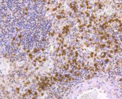Immunohistochemistry-Paraffin: Nrf2 Antibody [NBP3-09069] - Immunohistochemical analysis of paraffin-embedded human spleen tissue using anti-Nrf2 antibody. The section was pre-treated using heat mediated antigen retrieval with Tris-EDTA buffer (pH 8.0-8.4) for 20 minutes.The tissues were blocked in 5% BSA for 30 minutes at room temperature, washed with ddH2O and PBS, and then probed with the primary antibody (1/200) for 30 minutes at room temperature. The detection was performed using an HRP conjugated compact polymer system. DAB was used as the chromogen. Tissues were counterstained with hematoxylin and mounted with DPX.