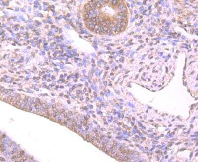 Immunohistochemistry-Paraffin: Nrf2 Antibody [NBP3-09069] - Immunohistochemical analysis of paraffin-embedded human uterus  tissue using anti-Nrf2 antibody. The section was pre-treated using heat mediated antigen retrieval with Tris-EDTA buffer (pH 8.0-8.4) for 20 minutes.The tissues were blocked in 5% BSA for 30 minutes at room temperature, washed with ddH2O and PBS, and then probed with the primary antibody (1/50) for 30 minutes at room temperature. The detection was performed using an HRP conjugated compact polymer system. DAB was used as the chromogen. Tissues were counterstained with hematoxylin and mounted with DPX.