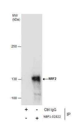 Immunoprecipitation of NRF2 protein from HepG2 whole cell extracts using 5 ug of NRF2 antibody [N2C2], Internal Western blot analysis was performed using NRF2 antibody [N2C2], Internal.. EasyBlot anti-Rabbit IgG was used as a secondary reagent.