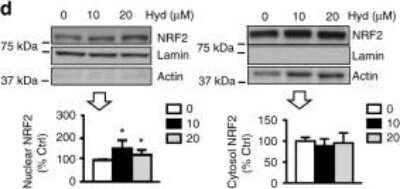<b>Biological Strategies Validation. </b>Nrf2-Antibody-Western-Blot-NBP1-32822-img0047.jpg