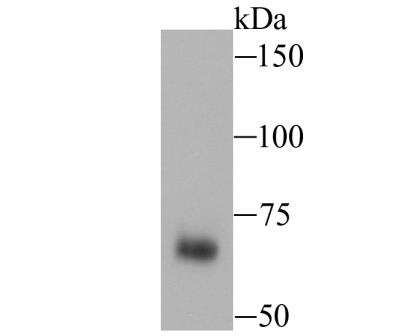 Western Blot: Nrf2 Antibody [NBP3-09069] - Western blot analysis of Nrf2 on mouse liver tissue lysate. Proteins were transferred to a PVDF membrane and blocked with 5% BSA in PBS for 1 hour at room temperature. The primary antibody (ER1706-41, 1/500) was used in 5% BSA at room temperature for 2 hours. Goat Anti-Rabbit IgG - HRP Secondary Antibody at 1:5,000 dilution was used for 1 hour at room temperature.