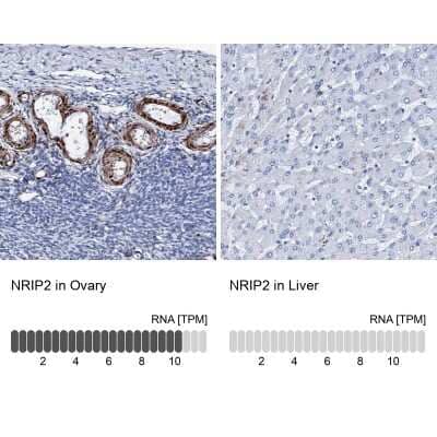 Immunohistochemistry-Paraffin Nrip2 Antibody - BSA Free