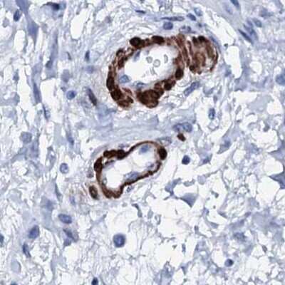 Immunohistochemistry-Paraffin Nrip2 Antibody - BSA Free