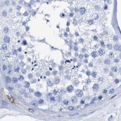 Immunohistochemistry-Paraffin Nrip2 Antibody - BSA Free