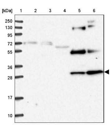 Western Blot Nrip2 Antibody - BSA Free