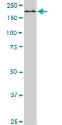 Western Blot: NuMA Antibody [H00004926-D01P] - Analysis of NUMA1 expression in human spleen.