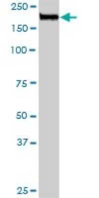 Western Blot: NuMA Antibody [H00004926-D01P] - Analysis of NUMA1 expression in mouse spleen.