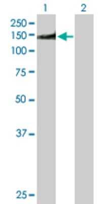 Western Blot: NuMA Antibody [H00004926-D01P] - Analysis of NUMA1 expression in transfected 293T cell line by NUMA1 polyclonal antibody.Lane 1: NUMA1 transfected lysate(133.20 KDa).Lane 2: Non-transfected lysate.