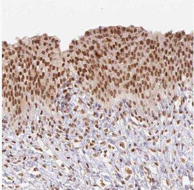 Immunohistochemistry-Paraffin: Nuclear Factor Erythroid 2 Related Factor 1 Antibody [NBP2-39057] - Staining of human urinary bladder shows moderate nuclear positivity in urothelial cells.