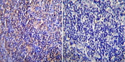 Immunohistochemistry-Paraffin: Nuclear Pore-O-Linked Glycoprotein Antibody (RL1) [NB600-1068] - Immunohistochemistry was performed on normal biopsies of deparaffinized Rat lymph node tissue. To expose target proteins, heat induced antigen retrieval was performed using 10mM sodium citrate (pH6.0)  buffer, microwaved for 8-15 minutes. Following antigen retrieval tissues were blocked in 3% BSA-PBS for 30 minutes at room temperature. Tissues were then probed at a dilution of 1:200 with a mouse monoclonal antibody recognizing Nuclear Pore-O-Linked Glycoprotein or without primary antibody (negative control) overnight at 4C in a humidified chamber. Tissues were washed extensively with PBST and endogenous peroxidase activity was quenched with a peroxidase suppressor.  Tissues were counterstained with hematoxylin and prepped for mounting.