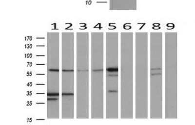 Western Blot: Nucleobindin 1 Antibody (OTI1A5) - Azide and BSA Free [NBP2-73086] - Analysis of extracts (10ug) from 9 Human tissue by using anti-NUCB1 monoclonal antibody at 1:200 (1: Testis; 2: Omentum; 3: Uterus; 4: Breast; 5: Brain; 6: Liver; 7: Ovary; 8: Thyroid gland; 9: colon).