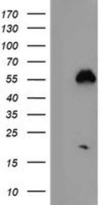 Western Blot: Nucleobindin 1 Antibody (OTI1A5) - Azide and BSA Free [NBP2-73086] - HEK293T cells were transfected with the pCMV6-ENTRY control (Left lane) or pCMV6-ENTRY Nucleobindin 1 (Right lane) cDNA for 48 hrs and lysed. Equivalent amounts of cell lysates (5 ug per lane) were separated by SDS-PAGE and immunoblotted with anti-Nucleob