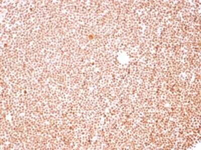 Immunohistochemistry-Paraffin: Nucleoli Marker Antibody (NM95) - Azide and BSA Free [NBP2-34695] - Formalin-fixed, paraffin-embedded human Tonsil stained with Nucleoli Marker Antibody (NM95).