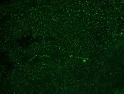 Immunohistochemistry-Paraffin: Nucleoli Marker Antibody (NM95) - Azide and BSA Free [NBP2-34695] - Staining of human colon ca.