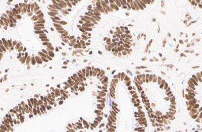 Immunohistochemistry-Paraffin: Nucleoli Marker Antibody (NM95) [Biotin] [NBP2-34695B] - Human ovarian cancer cell line, staining of nucleoli. Antibody at 1:150. Image from verified customer review.
