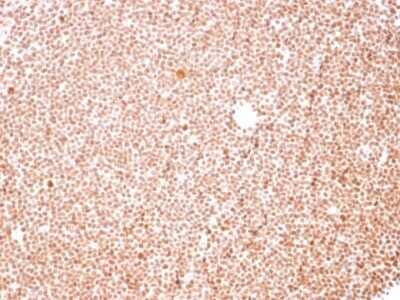 Immunohistochemistry-Paraffin: Nucleoli Marker Antibody (NM95) - IHC-Prediluted [NBP2-45215] - Formalin-fixed, paraffin-embedded human Tonsil stained with Nucleoli Marker Antibody (NM95).