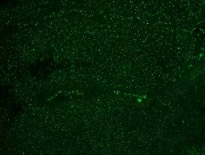 Immunohistochemistry-Paraffin: Nucleoli Marker Antibody (NM95) [NBP2-32886] - Staining of human colon ca.
