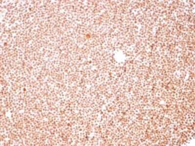 Immunohistochemistry-Paraffin: Nucleoli Marker Antibody (NM95) [NBP2-32886] - Formalin-fixed, paraffin-embedded human Tonsil stained with Nucleoli Marker Antibody (NM95).