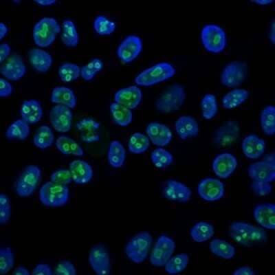 Immunocytochemistry/Immunofluorescence: Nucleolin Antibody (364-5) - Azide and BSA Free [NBP2-47861] - Immunofluorescence Analysis HeLa cells labeling Nucleolin with Nucleolin Antibody (364-5) followed by Goat anti-Mouse IgG-CF488 (Green). The nuclear counterstain is DAPI (Blue).