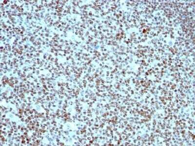 Immunohistochemistry-Paraffin: Nucleolin Antibody (364-5) - Azide and BSA Free [NBP2-47861] - Human Tonsil stained with Nucleolin Monoclonal Antibody (364-5).