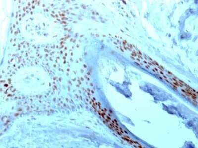 Immunohistochemistry-Paraffin: Nucleolin Antibody (364-5) - Azide and BSA Free [NBP2-47861] - Human Skin stained with Nucleolin Monoclonal Antibody (364-5).