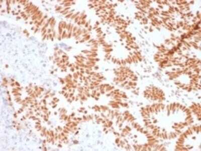 Immunohistochemistry-Paraffin: Nucleolin Antibody (NCL/902) - Azide and BSA Free [NBP2-47860] - Formalin-fixed, paraffin-embedded human colon stained with Nucleolin Antibody (NCL/902).