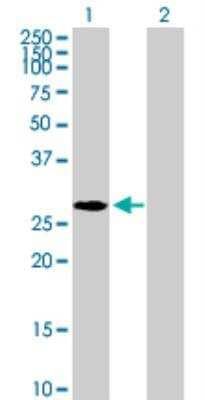 Western Blot: Nucleoplasmin-2 Antibody [H00010361-B01P] - analysis of NPM2 expression in transfected 293T cell line by NPM2 MaxPab polyclonal antibody. Lane 1: NPM2 transfected lysate (23.54 KDa). Lane 2: Non-transfected lysate.