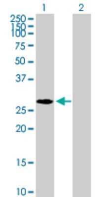 Western Blot: Nucleoplasmin-2 Antibody [H00010361-B01P] - Analysis of NPM2 expression in transfected 293T cell line by NPM2 polyclonal antibody.  Lane 1: NPM2 transfected lysate(23.54 KDa). Lane 2: Non-transfected lysate.