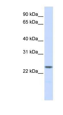 Western Blot: Nucleoplasmin-2 Antibody [NBP1-58109] - Titration: 0.2-1 ug/ml, Positive Control: Human Placenta.