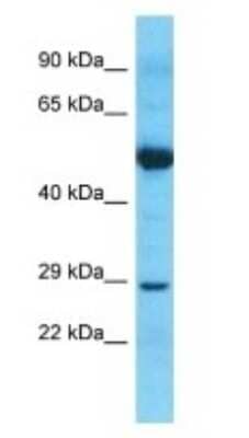 Western Blot: Nucleoplasmin-2 Antibody [NBP3-09372] - Western blot analysis of Nucleoplasmin-2 in Thymus Tumor lysates. Antibody dilution at 1.0ug/ml