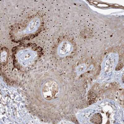 Immunohistochemistry-Paraffin Nucleoplasmin-3 Antibody - BSA Free