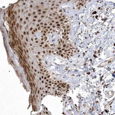 Immunohistochemistry-Paraffin Nucleoplasmin-3 Antibody