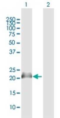 Western Blot: Nucleoplasmin-3 Antibody [H00010360-B01P] - Analysis of NPM3 expression in transfected 293T cell line by NPM3 polyclonal antibody.  Lane1:NPM3 transfected lysate(19.58 KDa). Lane2:Non-transfected lysate.