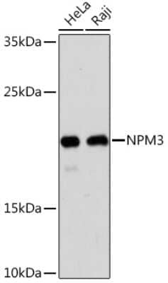 Western Blot: Nucleoplasmin-3 Antibody [NBP3-15545] - Western blot analysis of extracts of various cell lines, using Nucleoplasmin-3 Rabbit pAb (NBP3-15545) at 1:1000 dilution. Secondary antibody: HRP Goat Anti-Rabbit IgG (H+L) at 1:10000 dilution. Lysates/proteins: 25ug per lane. Blocking buffer: 3% nonfat dry milk in TBST. Detection: ECL Basic Kit. Exposure time: 90s.