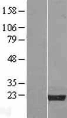 Western Blot: Nucleoplasmin-3 Overexpression Lysate (Adult Normal) [NBL1-13751] Left-Empty vector transfected control cell lysate (HEK293 cell lysate); Right -Over-expression Lysate for Nucleoplasmin-3.