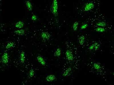 Immunocytochemistry/Immunofluorescence: Nucleoporin 107 Antibody [NBP2-99074] - Immunofluorescence staining of Nucleoporin 107 in A549 cells. Cells were fixed with 4% PFA, permeabilzed with 0.3% Triton X-100 in PBS, blocked with 10% serum, and incubated with rabbit anti- Nucleoporin 107 polyclonal antibody (1:5000) at 4C overnight. Then cells were stained with the Alexa Fluor(R)488-conjugated Goat Anti-rabbit IgG secondary antibody (green).Positive staining was localized to nucleus.