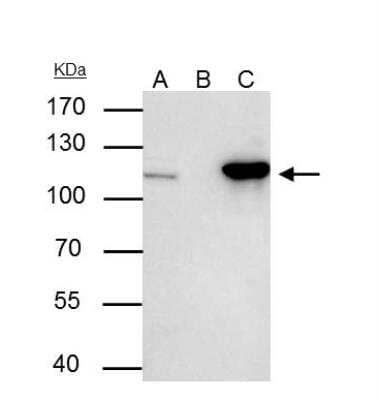 Immunoprecipitation: Nucleoporin 107 Antibody [NBP2-19602] - A : 30 ug whole cell lysate/extract of NUP107 protein expressing 293T cells B : Control with 3 ug of pre-immune rabbit IgG C : Immunoprecipitation of NUP107 by 3 ug of NUP107 antibody . 7.5% SDS-PAGE The immunoprecipitated NUP107 protein was detected by NUP107 antibody  diluted at 1 : 1000.