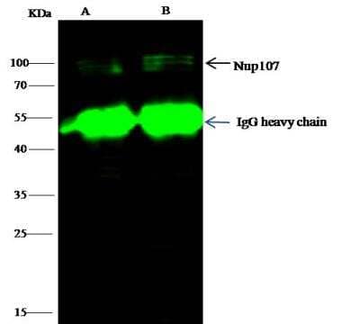 Immunoprecipitation: Nucleoporin 107 Antibody [NBP2-99074] - Lane A:0.5 mg A549 Whole Cell LysateLane B:0.5 mg Hela Whole Cell Lysate1 uL anti-NUP107 rabbit polyclonal antibody and 15 ul of 50 % Protein G agarose.Primary antibody:Anti-NUP107 rabbit polyclonal antibody,at 1:500 dilution Secondary antibody:Dylight 800-labeled antibody to rabbit IgG (H+L), at 1:5000 dilution Developed using the odssey technique.Performed under reducing conditions.Predicted band size: 106 kDaObserved band size: 106 kDa