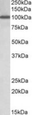 Western Blot: Nucleoporin 107 Antibody [NBP1-49841] - Western blot analysis of Nucleoporin 107 in Peripheral Blood Lymphocytes lysate (35ug protein in RIPA buffer) using NBP1-49841 at 1ug/ml. Primary incubation was 1 hour. Detected by chemiluminescence.