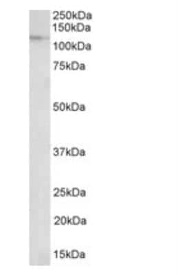 Western Blot: Nucleoporin 107 Antibody [NBP1-49841] -  Staining of nuclear lysate of NIH3T3 (35ug protein in RIPA buffer). Primary incubation was 1 hour. Detected by chemiluminescence.