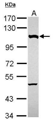 Western Blot: Nucleoporin 107 Antibody [NBP2-19602] - Sample (30 ug of whole cell lysate) A: Hela 7. 5% SDS PAGE gel, diluted at 1:1000.