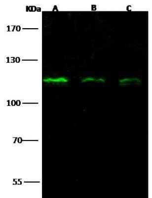 Western Blot: Nucleoporin 107 Antibody [NBP2-99074] - Lane A: A549 Whole Cell LysateLane B: Hela Whole Cell LysateLane C: 293T Whole Cell LysateLysates/proteins at 30 ug per lane.SecondaryGoat Anti- Rabbit  IgG H&L (Dylight 800)  at 1/10000 dilution.Developed using the Odyssey technique. Performed under reducing conditions.Predicted band size:106 kDaObserved band size:115 kDa