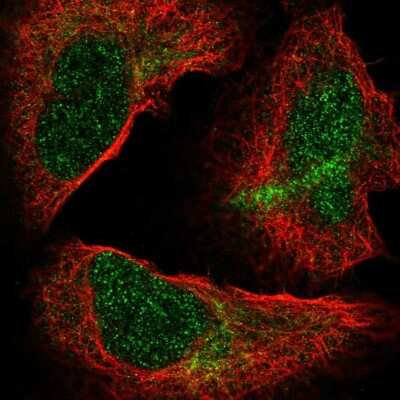 Immunocytochemistry/Immunofluorescence: Nucleoporin NUP85/Pericentrin 1 Antibody [NBP2-56709] - Staining of human cell line U-2 OS shows localization to nucleoplasm & cytosol.