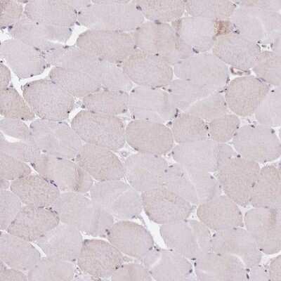 Immunohistochemistry-Paraffin: Nucleoporin NUP85/Pericentrin 1 Antibody [NBP2-31860] - Staining of human skeletal muscle shows low expression as expected.