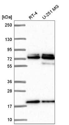 Western Blot: Nucleoporin NUP85/Pericentrin 1 Antibody [NBP2-56709] - Western blot analysis in human cell line RT-4 and human cell line U-251 MG.