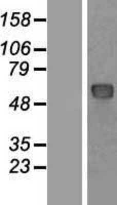 Western Blot: Nucleoporin p62 Overexpression Lysate (Adult Normal) [NBP2-10356] Left-Empty vector transfected control cell lysate (HEK293 cell lysate); Right -Over-expression Lysate for Nucleoporin p62.