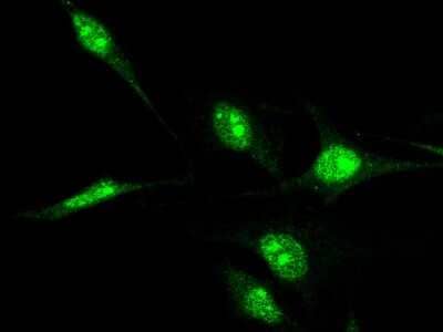 Immunocytochemistry/Immunofluorescence: Nucleostemin Antibody [NBP2-98743] - Immunofluorescence staining of Nucleostemin in HeLa cells. Cells were fixed with 4% PFA, blocked with 10% serum, and incubated with rabbit anti-human Nucleostemin polyclonal antibody (1:5000) at 4C overnight. Then cells were stained with the Alexa Fluor(R)488-conjugated Goat Anti-rabbit IgG Secondary antibody (green)Positive staining was localized to nucleus.